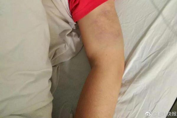 網(wǎng)絡(luò)詐騙有哪些方式_馬斯克親自點(diǎn)名Karpathy迎戰(zhàn)Grok 5！別