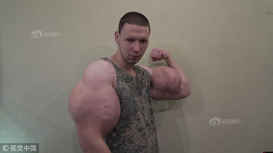 火絨設(shè)置禁止掃描功能_搜狐名醫(yī) | 北大腫瘤張關(guān)敏：吃藥應(yīng)“踩準(zhǔn)點(diǎn)”，每顆藥都有它的脾氣