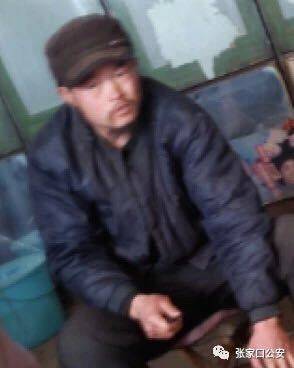 年輕人為何頻現(xiàn)一過性黑蒙