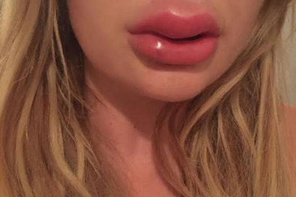 如何開通國外支付方式_為何要全面禁產(chǎn)水銀體溫計