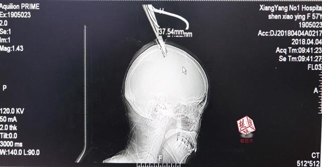 日本稱中方雷達(dá)照射日戰(zhàn)機(jī) 國(guó)防部回應(yīng)