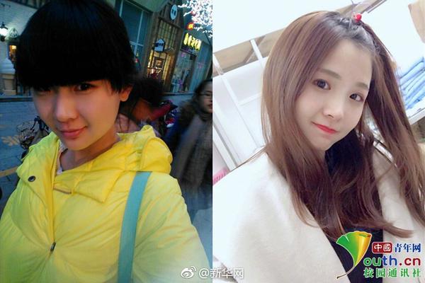 server2019安裝zabbix詳細(xì)教程_馮提莫停播近一年后復(fù)播 稱甲狀腺癌復(fù)發(fā)并轉(zhuǎn)移