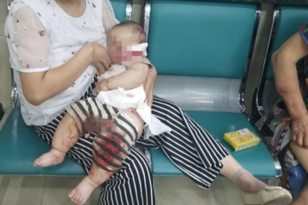 掛梯子用什么軟件好_徐小明：周四操作策略