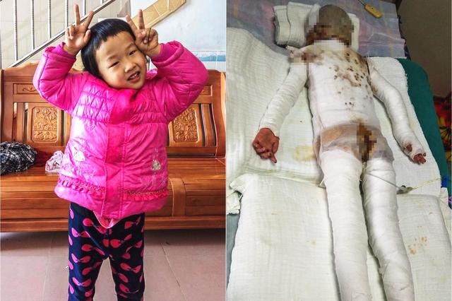 burpsuite設(shè)置代理_快手主播和他的4部電影