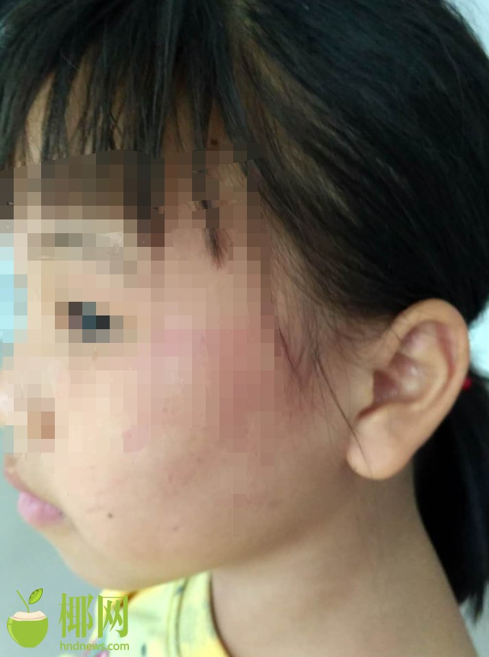 網(wǎng)絡(luò)課堂爆破三員培訓(xùn)網(wǎng)址是什么_兒童面膜是盲目消費(fèi)嗎