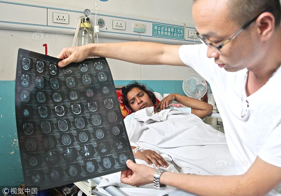 領(lǐng)英linkedin國際版官網(wǎng)_魔術(shù)師表演毫無破綻 看不出他竟是盲人