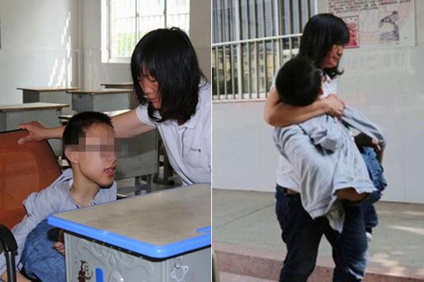 抖音快手視頻采集工具_11歲男孩確診重度脂肪肝