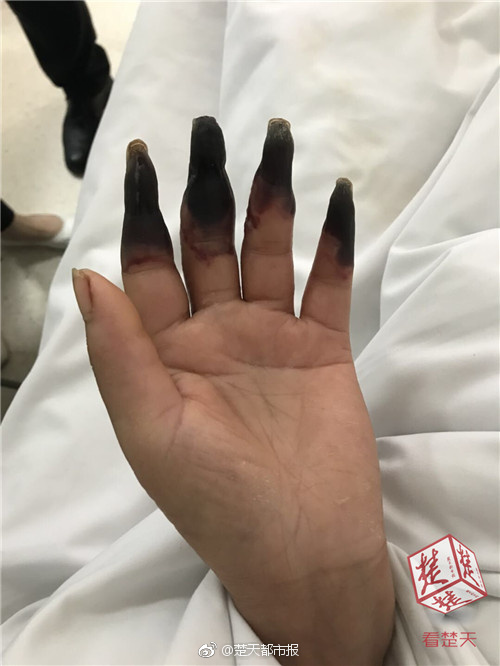 群暉修復(fù)嚴重任意代碼執(zhí)行漏洞_臺灣，禁不掉的小紅書