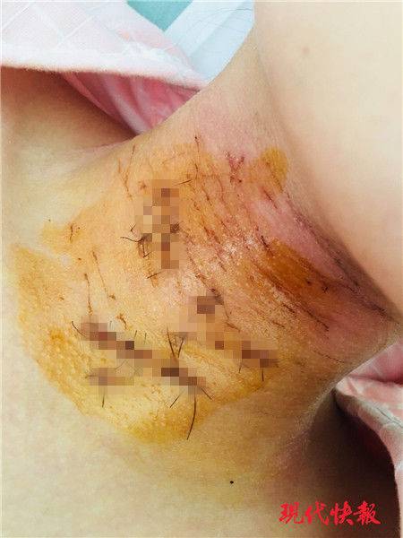 怎么破解網頁vip視頻_泰柬邊境局勢升級：泰國出動F-16 柬埔寨發(fā)射火箭彈