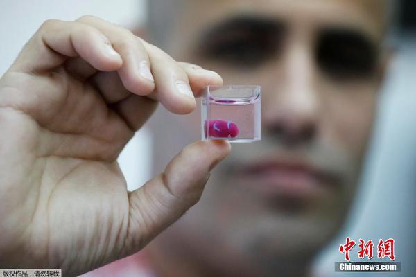 藍云erp是局域網(wǎng)嗎_小長假曬表攻略 贏得朋友圈攝影大賽