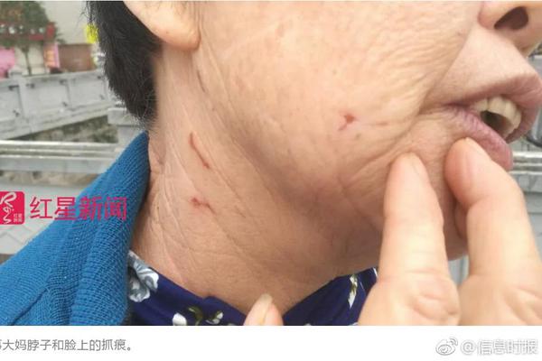 圖片源碼查看_回鄉(xiāng)探親帶了10個(gè)保鏢，進(jìn)村看到養(yǎng)父被鎖狗籠，村霸：你算老幾！